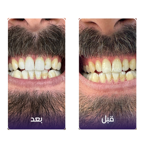 before-&-after-1